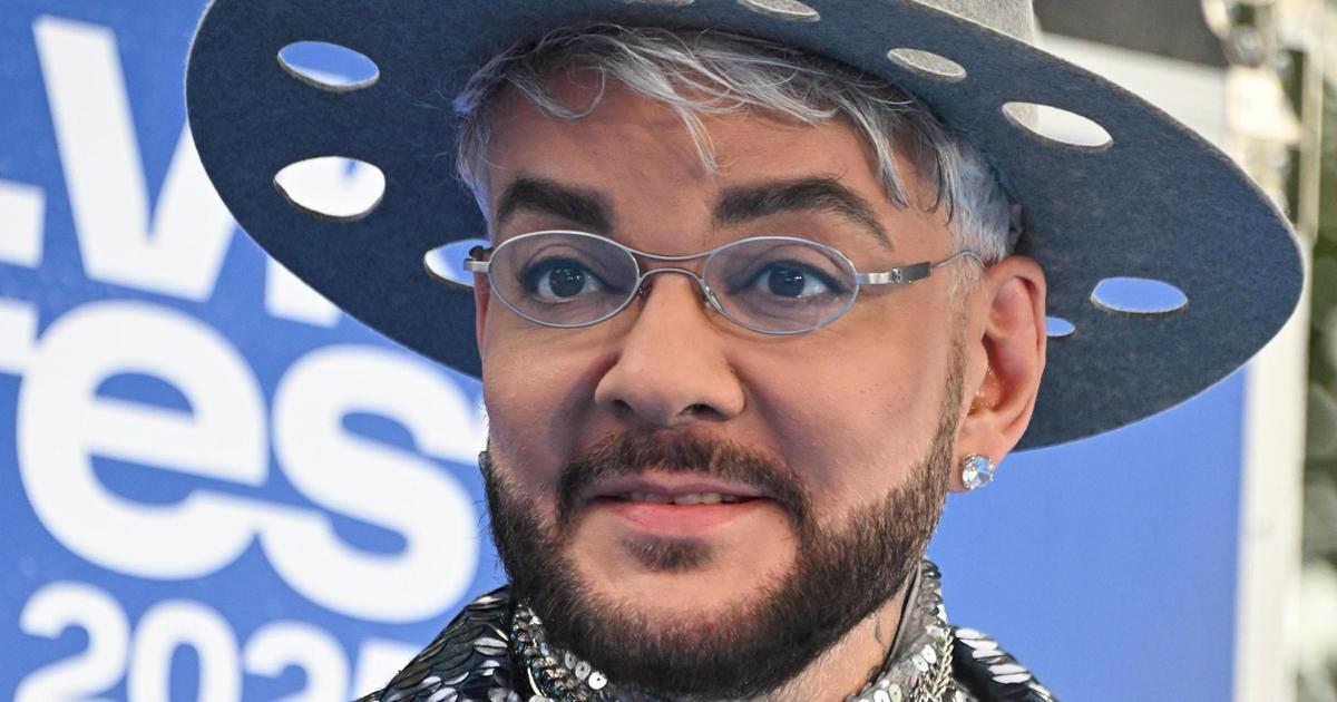 «Я никого не виню, только себя»: Филипп Киркоров показал, что стало с его ногой после падения на сцене