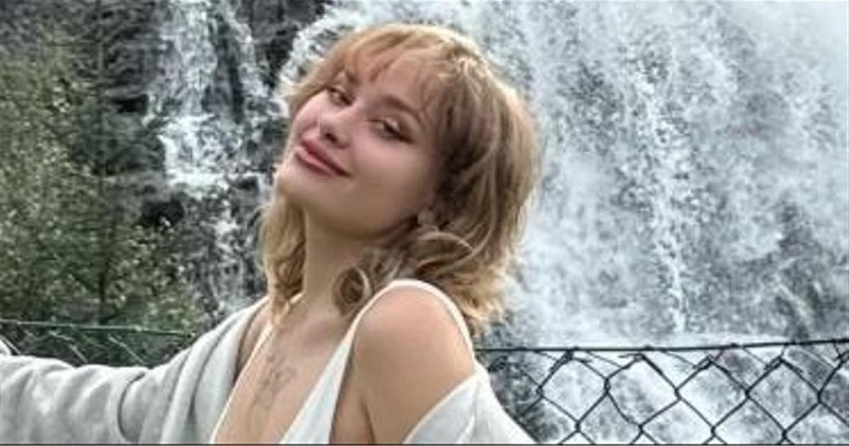 Пострадавшая в Дубае Мария Ковальчук о том, как она приняла свою новую внешность: «Не знала, каково это — жить с изуродованным лицом»