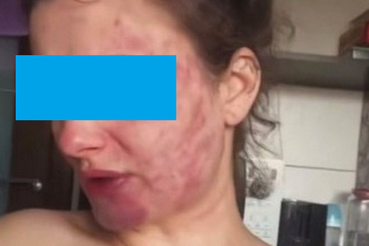 Бывший муж преследует калининградку: удары головой о руль, пытки и удушение.