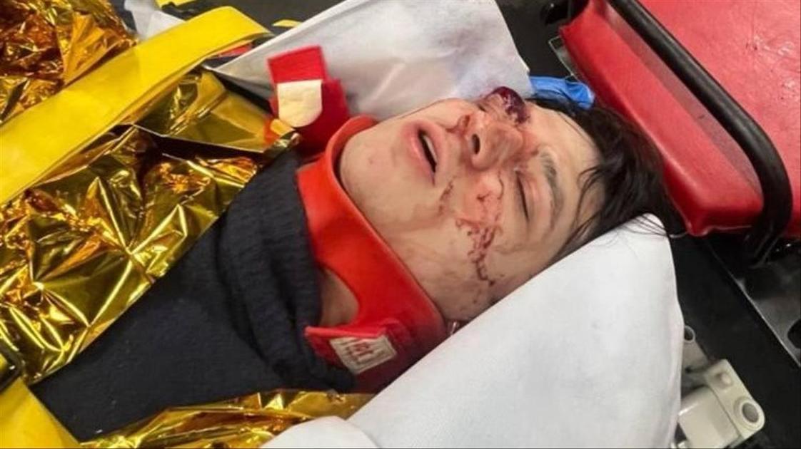 Рэпер Vacio упал с третьего этажа в Париже — его в реанимации в критическом состоянии.