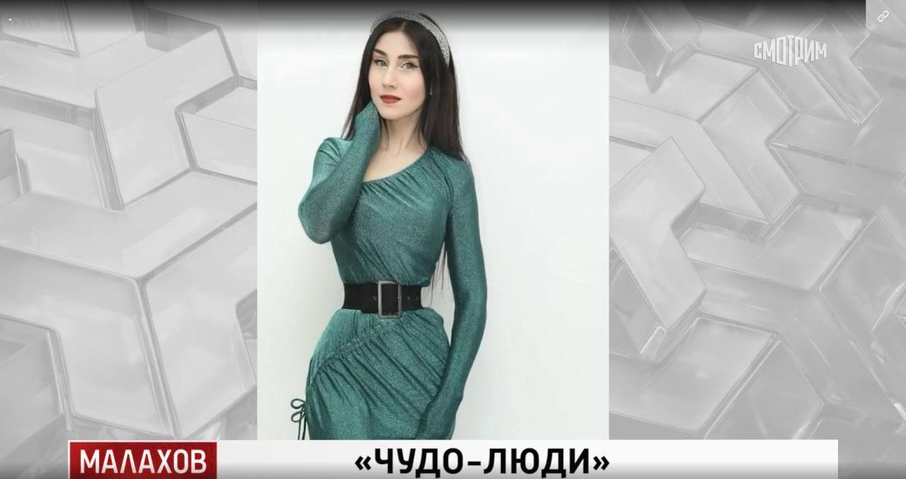 Обладательница самого большого рта в России Александра Смолякова: «Это сильно помогает в жизни, особенно в личных отношениях»