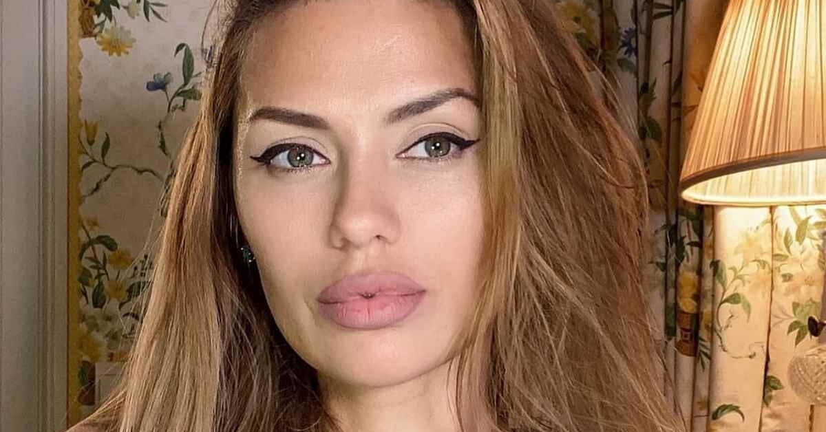 Виктория Боня выбрала сделать косметическую процедуру для подтяжки кожи на ногах.