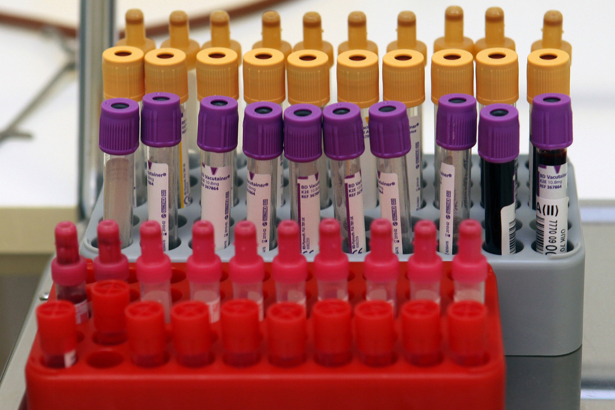 В крови «богородского маньяка» найдены наркотики.