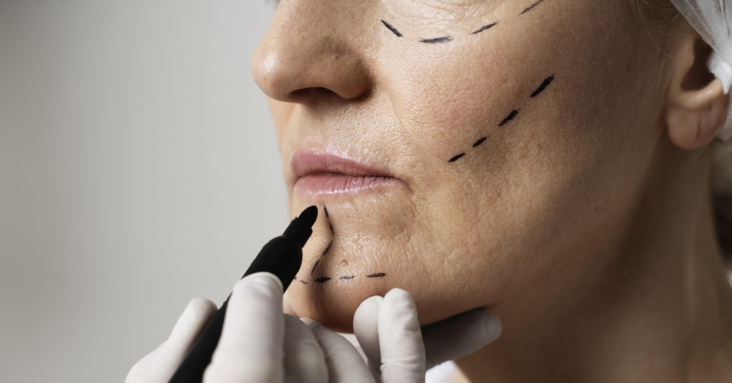 Как свежий тренд в пластической хирургии восстановил популярность естественной красоты